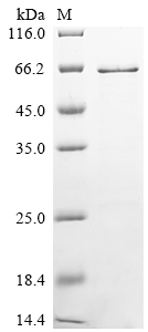 Recombinant Mouse Adenomatous polyposis coli protein (Apc), partial