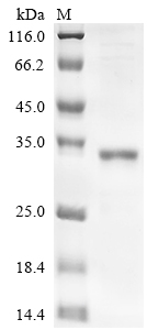 Recombinant Human FAS-associated death domain protein (FADD)