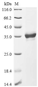 Recombinant Trachypithecus cristatus Cytochrome c oxidase subunit 7A1, mitochondrial (COX7A1), partial