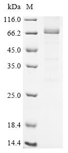 Recombinant Human Serine/threonine-protein kinase RIO3 (RIOK3)