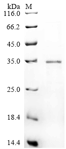 Recombinant Bovine Insulin-like growth factor II (IGF2), partial