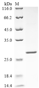 Recombinant Human Calbindin (CALB1)