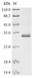 Recombinant Human Transcriptional enhancer factor TEF-4 (TEAD2), partial