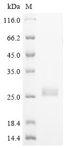 Recombinant Human TGF-beta receptor type-2 (TGFBR2), partial