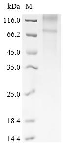 Recombinant Human Frizzled-3 (FZD3)