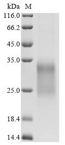 Recombinant Mouse IGF-like family receptor 1 (Igflr1), partial