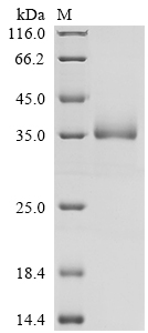 Recombinant Human Vesicular integral-membrane protein VIP36 (LMAN2), partial