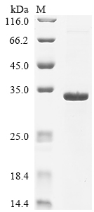 Recombinant Rabies virus Matrix protein (M)