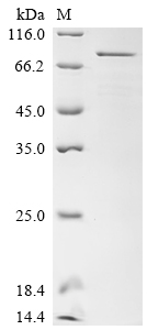 Recombinant Human Transcriptional coactivator YAP1 (YAP1)