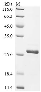 Recombinant Chicken Fibroblast growth factor 2 (FGF2)