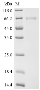 Recombinant Human Tumor necrosis factor receptor superfamily member 6B (TNFRSF6B)