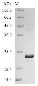 Recombinant Mouse Transient receptor potential cation channel subfamily V member 4 (Trpv4), partial