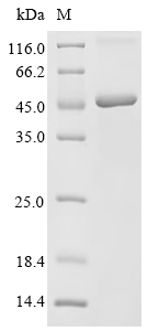 Recombinant Simian retrovirus SRV-1 Envelope glycoprotein (env), partial