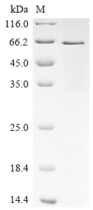 Recombinant Human Cellular tumor antigen p53 (TP53) (Y220C)