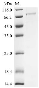 Recombinant Human Protein mono-ADP-ribosyltransferase PARP10 (PARP10), partial