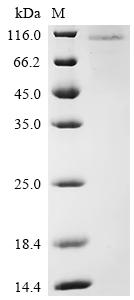 Recombinant Human Protein mono-ADP-ribosyltransferase PARP3 (PARP3)