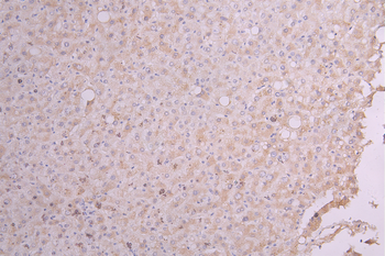 IGF1 Antibody