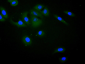 IL15 Antibody