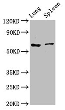 RIPK2 Antibody