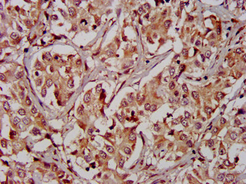 RIPK2 Antibody