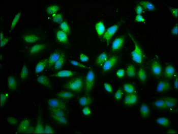 RIPK2 Antibody