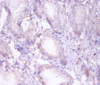 HADHB Antibody