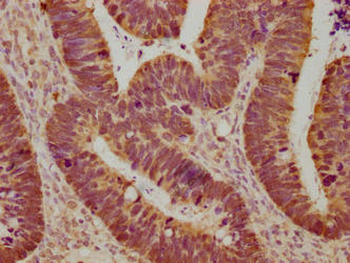 LGALS3 Antibody