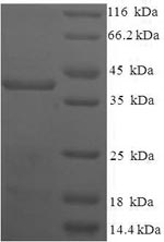 Human TGIF2LX protein