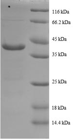 Human COX5A protein