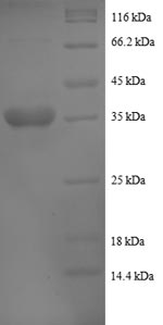 Human QP-C protein
