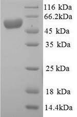 Human ALPI protein