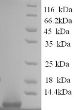 Human Glucagon protein