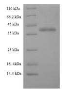 Human CHMP5 protein