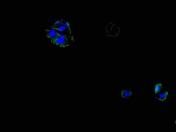 SLC6A6 Antibody