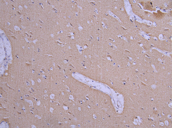 TUBB Antibody