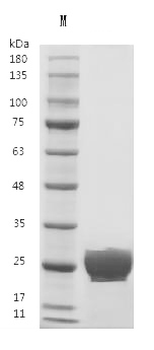 Recombinant Human Vascular endothelial growth factor A, long form (VEGFA) (Active)