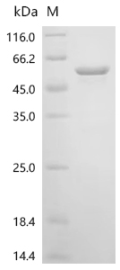 Recombinant Human Casein kinase I isoform delta (CSNK1D)