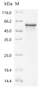 Recombinant Human Casein kinase I isoform delta (CSNK1D)