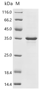 Recombinant Human Transcriptional enhancer factor TEF-4 (TEAD2), partial