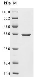 Recombinant Human Transcriptional enhancer factor TEF-3 (TEAD4), Partial