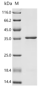 Recombinant Human Transcriptional enhancer factor TEF-4 (TEAD2), partial