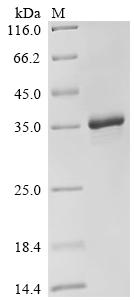 Recombinant Human Protein mono-ADP-ribosyltransferase PARP16 (PARP16), partial
