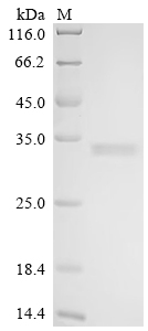 Recombinant Human Protein mono-ADP-ribosyltransferase PARP16 (PARP16), partial