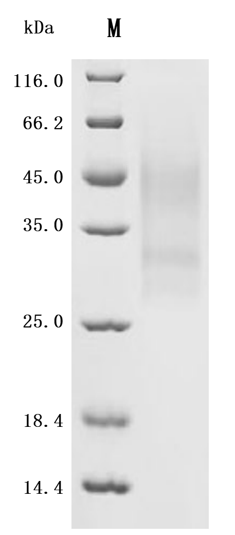 Recombinant Human Tumor necrosis factor receptor superfamily member 3 (LTBR), partial (Active)