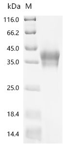 Recombinant Human Interleukin-15 receptor subunit alpha (IL15RA), partial