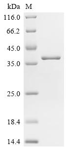 Recombinant Human Charged multivesicular body protein 2b (CHMP2B)