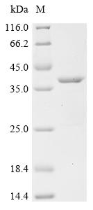 Recombinant Mouse CD81 antigen (Cd81), partial