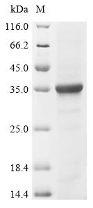 Recombinant Human Protein mono-ADP-ribosyltransferase PARP8 (PARP8), partial