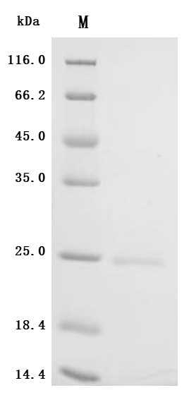 Recombinant Human Sodium-dependent phosphate transport protein 2B (SLC34A2), partial
