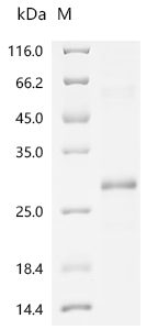 Recombinant Human Tumor necrosis factor receptor superfamily member 3 (LTBR), partial
